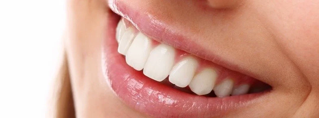 Tandvleesziekte of Parodontale Ziekte